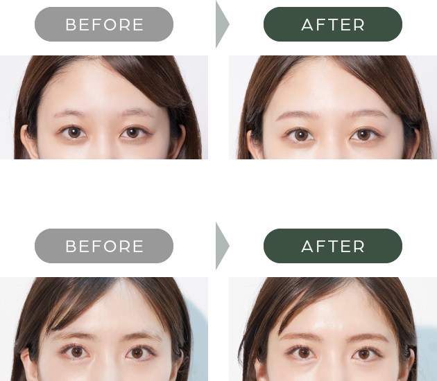 BEFORE AFTER