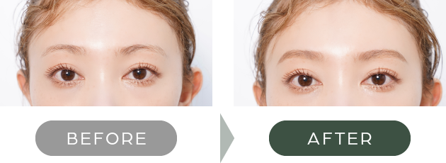 BEFORE AFTER