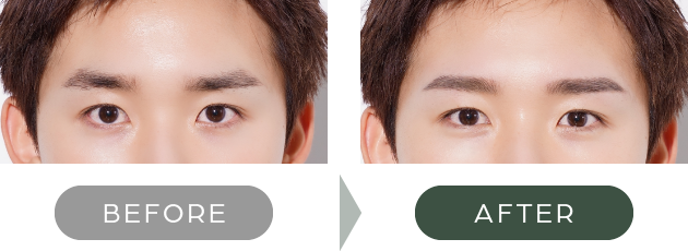 BEFORE AFTER